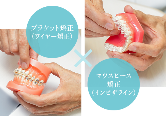 ブラケット矯正（ワイヤー矯正）マウスピース矯正（インビザライン）
