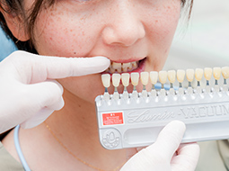 ホワイトニング