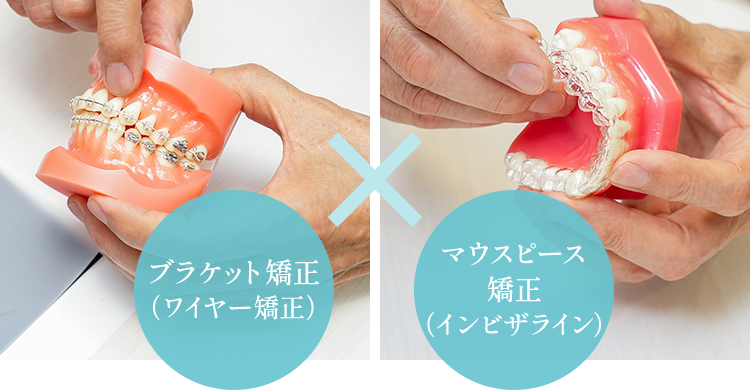 ブラケット矯正（ワイヤー矯正）マウスピース矯正（インビザライン）