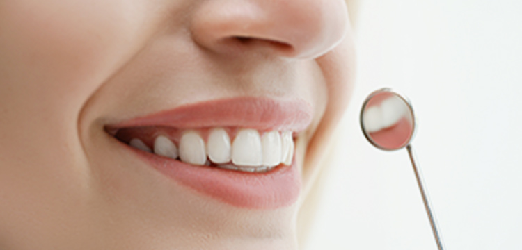 セラミック審美治療