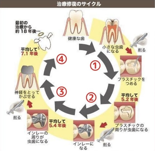 治療修復のサイクル